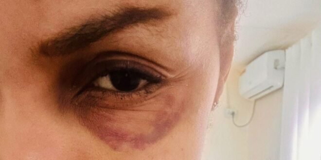 Editorial: Justice for Toni Jackson