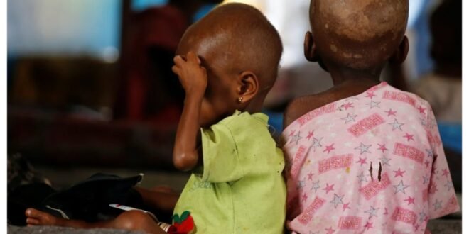 440,000 Nigerian children treated for malnutrition in 2025 – MSF