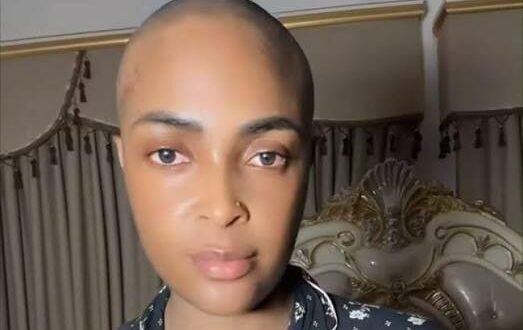A blessed CEO triggers new health problems with strange body changes