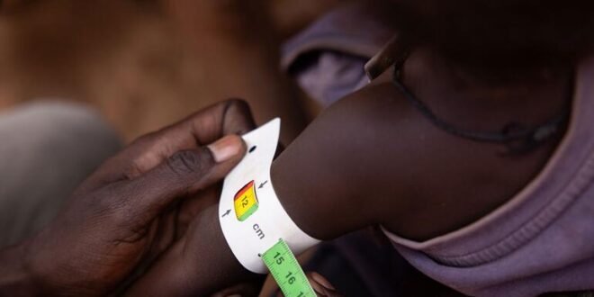 Worsening hunger could push millions closer to starvation in 13 global hotspots