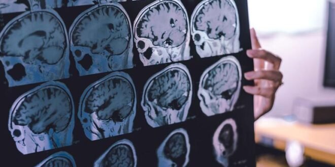 New guidelines offer hope for reducing the number of dementia victims globally