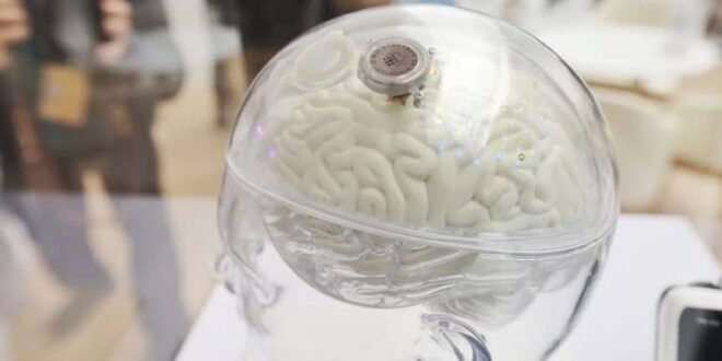 China approves brain implant to help paralysis patients use their hands